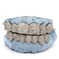 Custom Zigzag Hand Diamond Setting White Gold Grillz [HS 002]