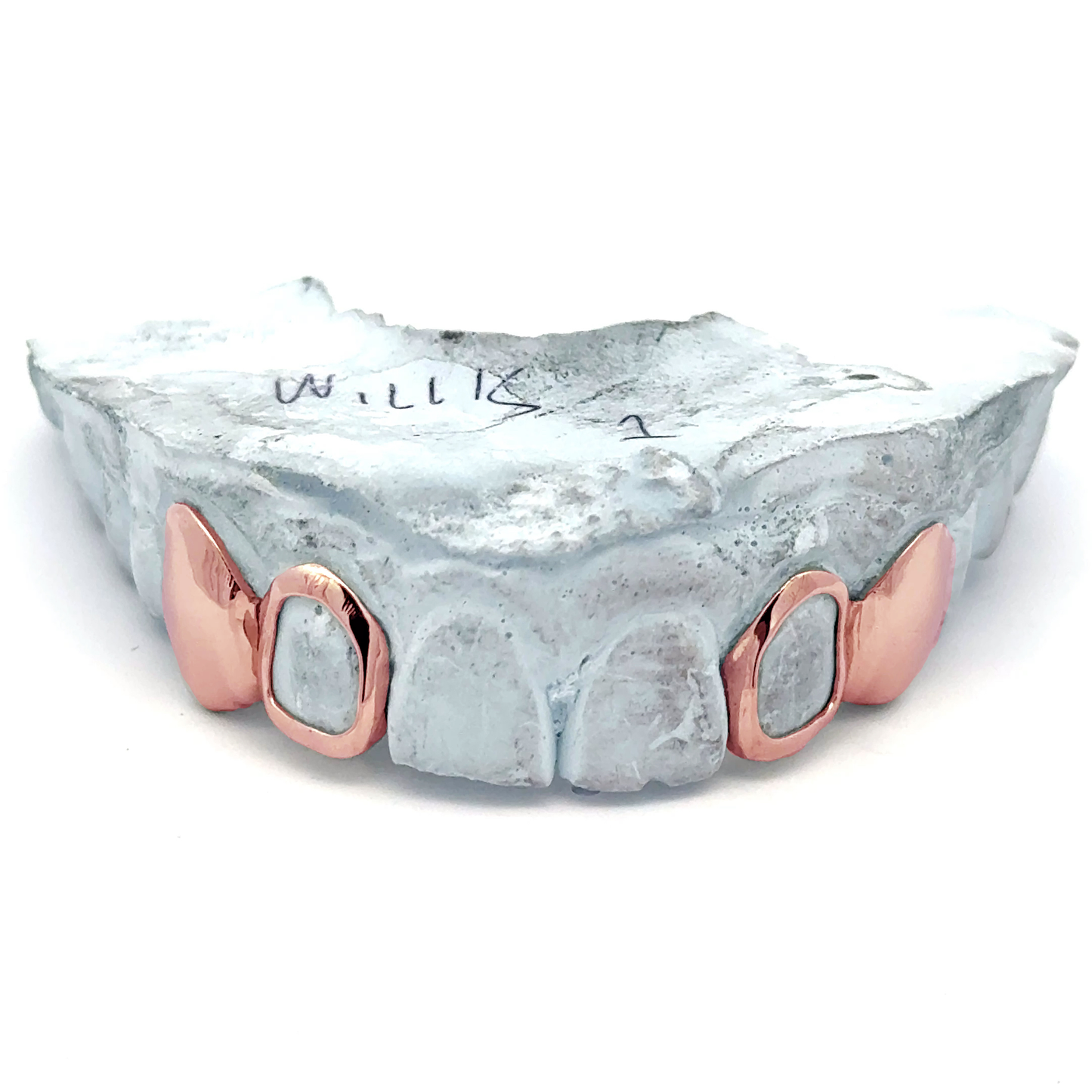 Custom 4 Teeth - 2 Solid & 2 Open Face Grillz