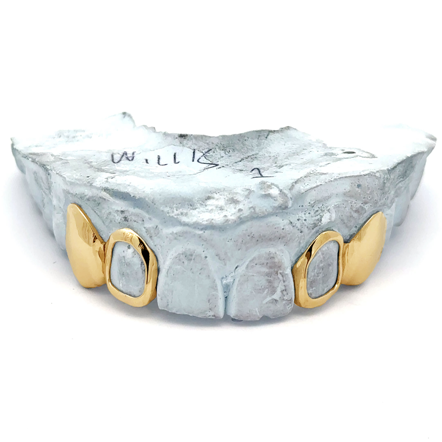 Custom 4 Teeth - 2 Solid & 2 Open Face Grillz