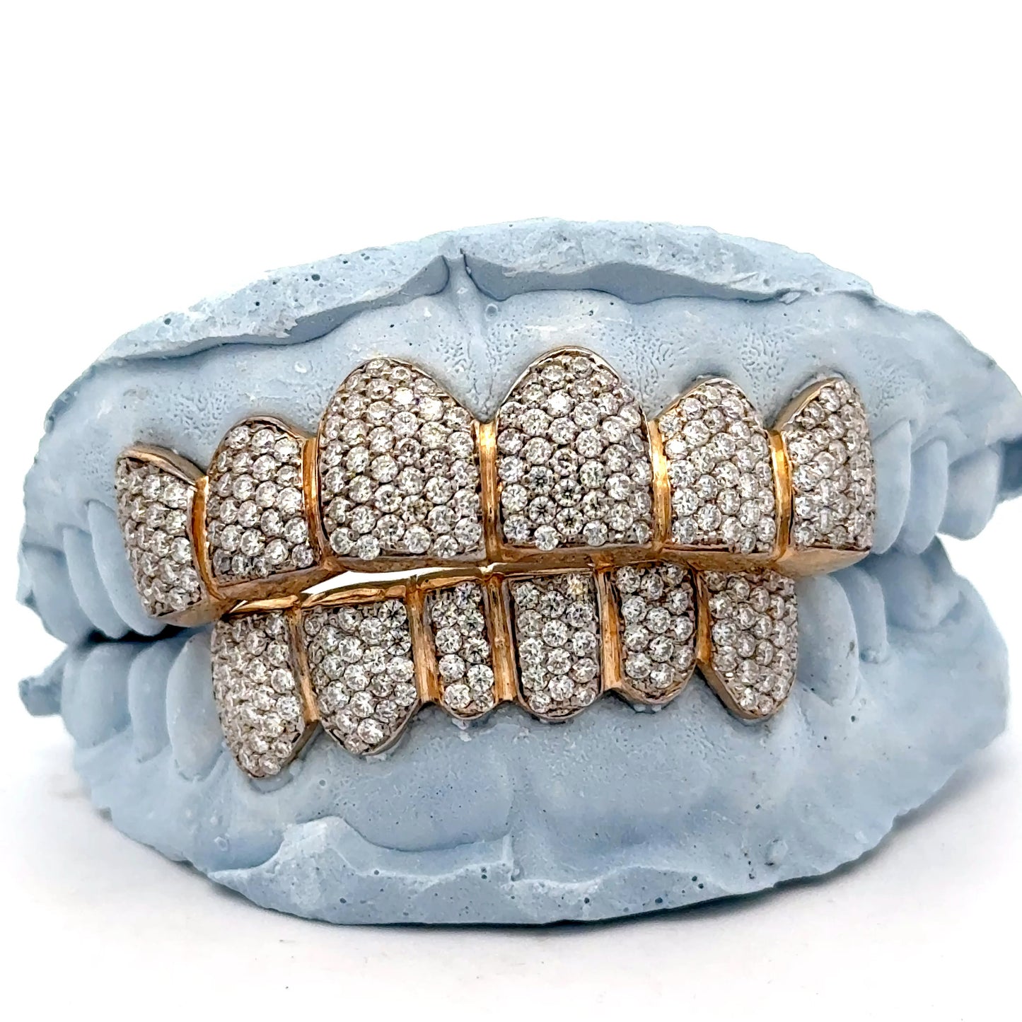 Custom Diamond Pave Setting Gold Grillz [HS 001]