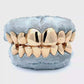 Custom Solid Grillz [SG001]