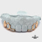 Solid, Open, & Diamond Bar Grillz